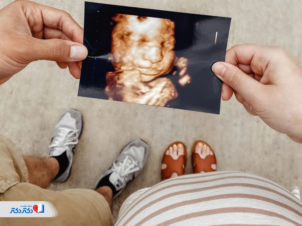 سونوگرافی سهبعدی جنین؛ مشاهده چهره و اندام نوزاد