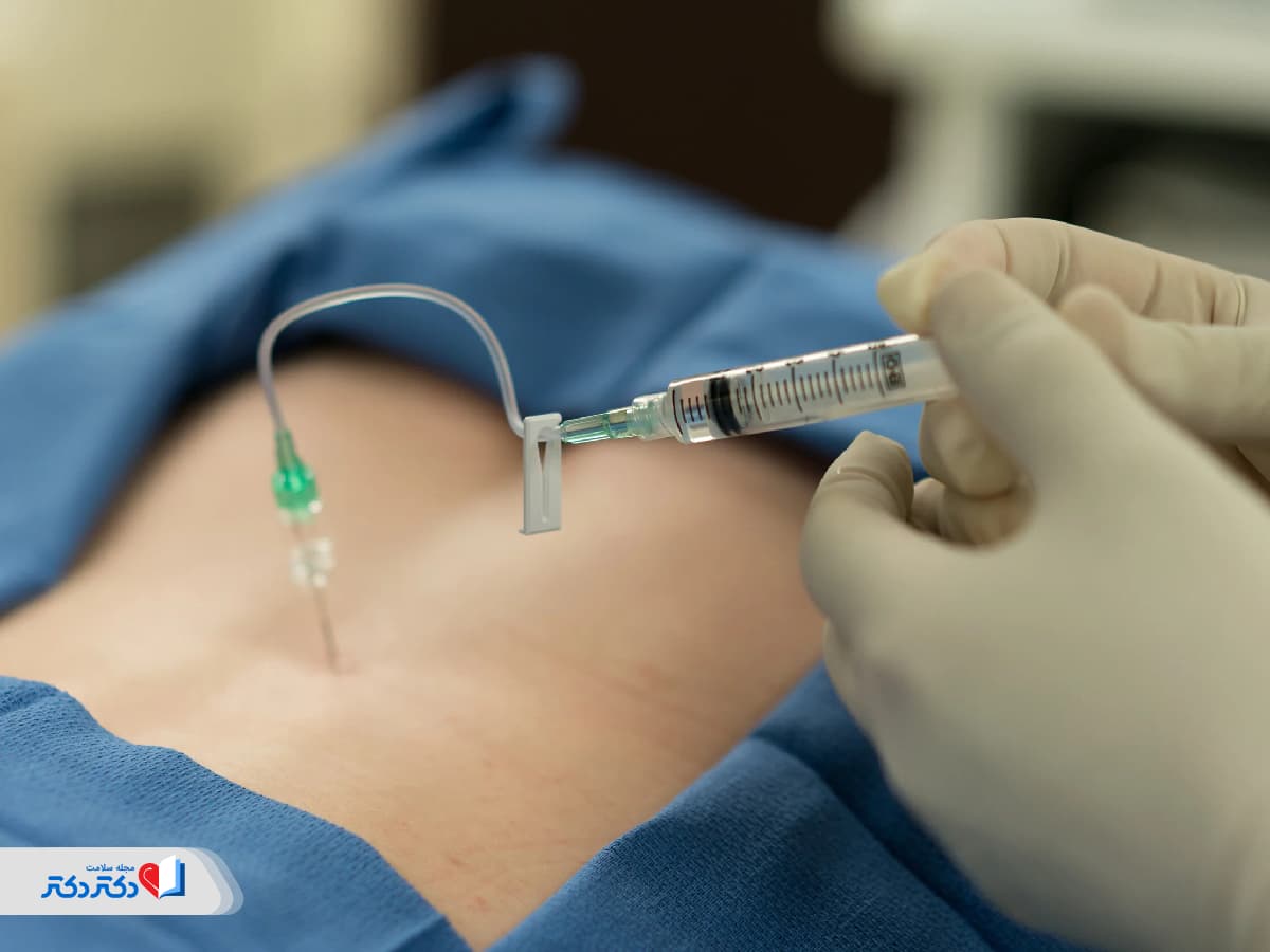 آزمایش ام اس چیست؟ راهنمای تشخیص این بیماری خودایمن