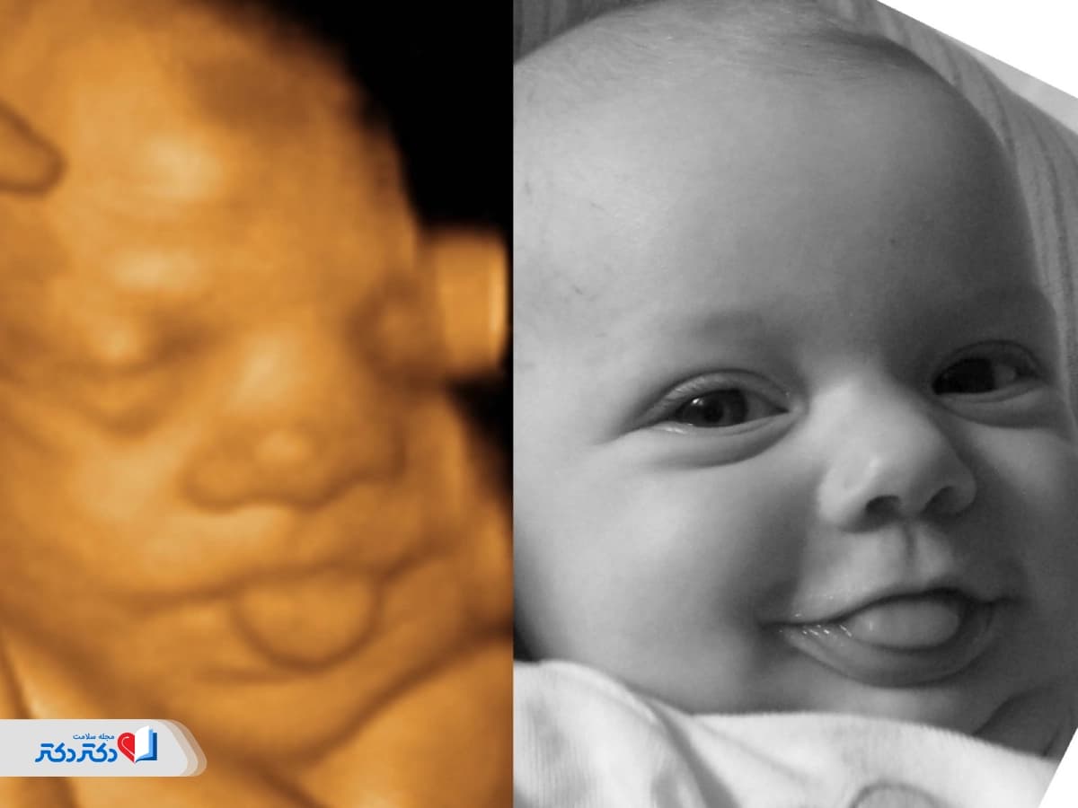 سونوگرافی چهاربعدی؛ تصاویر زنده از حرکات واقعی جنین