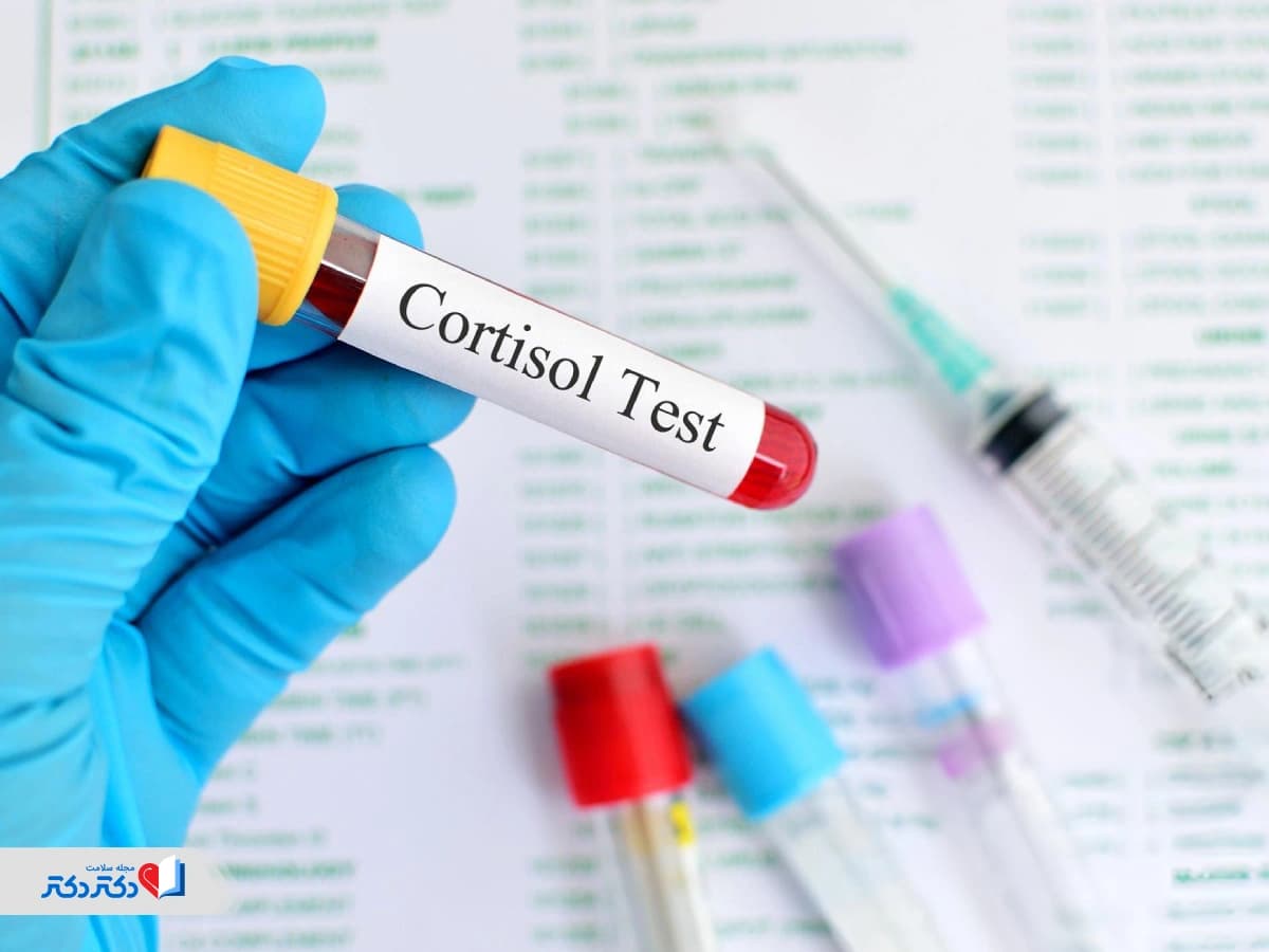 تفسیر آزمایش کورتیزول: میزان نرمال، شرایط انجام و هزینه