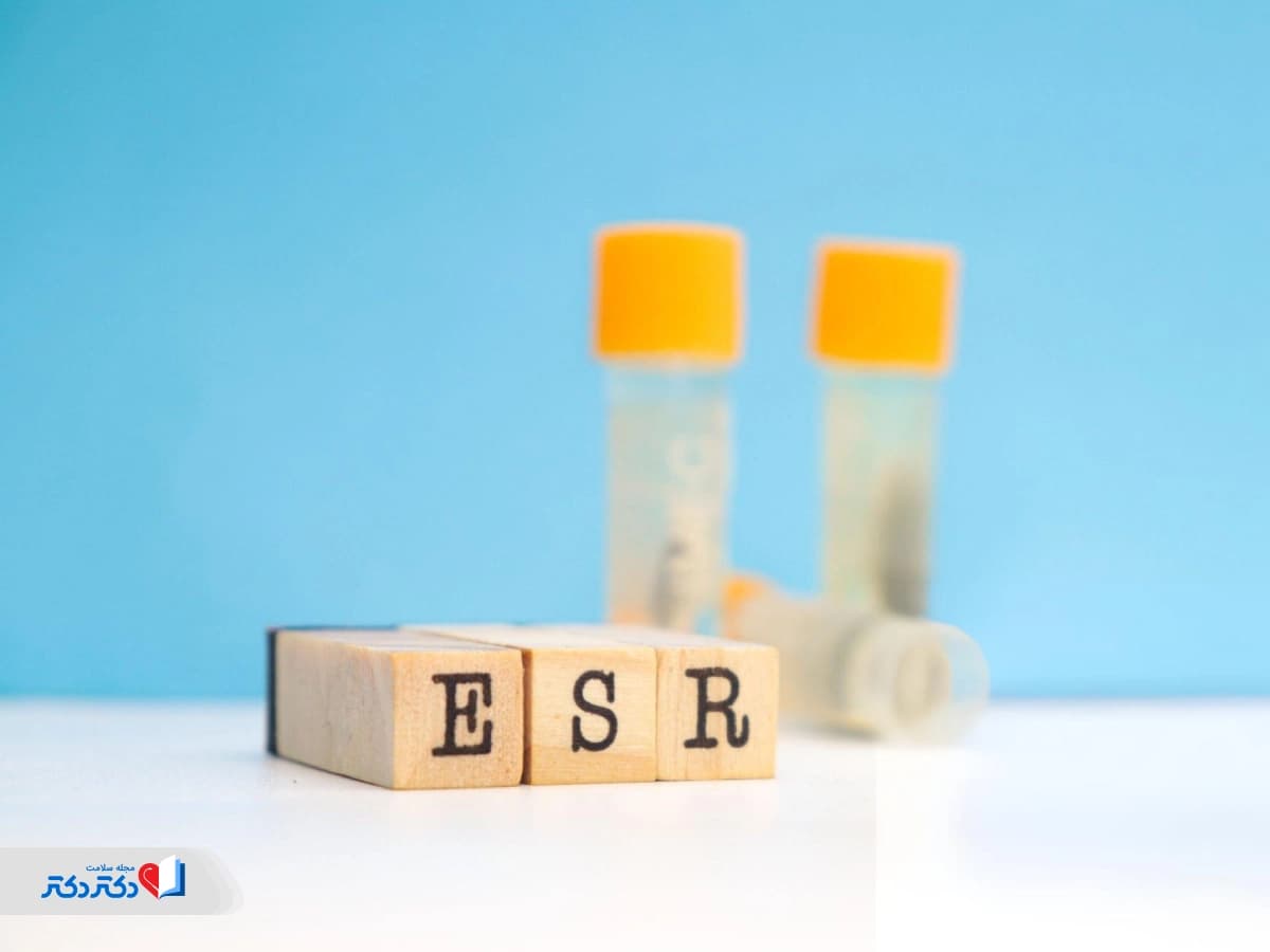 مقدار نرمال ESR در آزمایش خون و ارتباط آن با سرطان خون