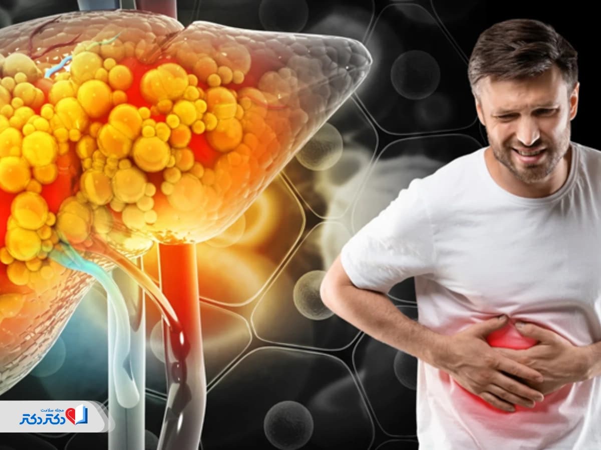 کبد چرب گرید ۲ چیست؟ علائم، خطرناک بودن، درمان و برگشت به گرید ۱