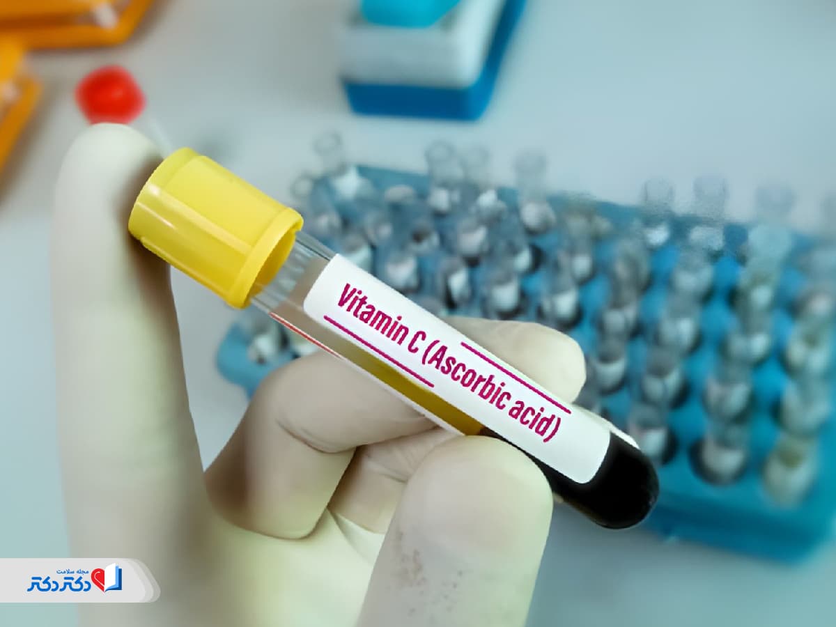 آزمایش ویتامین C چیست؟ تفسیر و عوارض کمبود VIT C