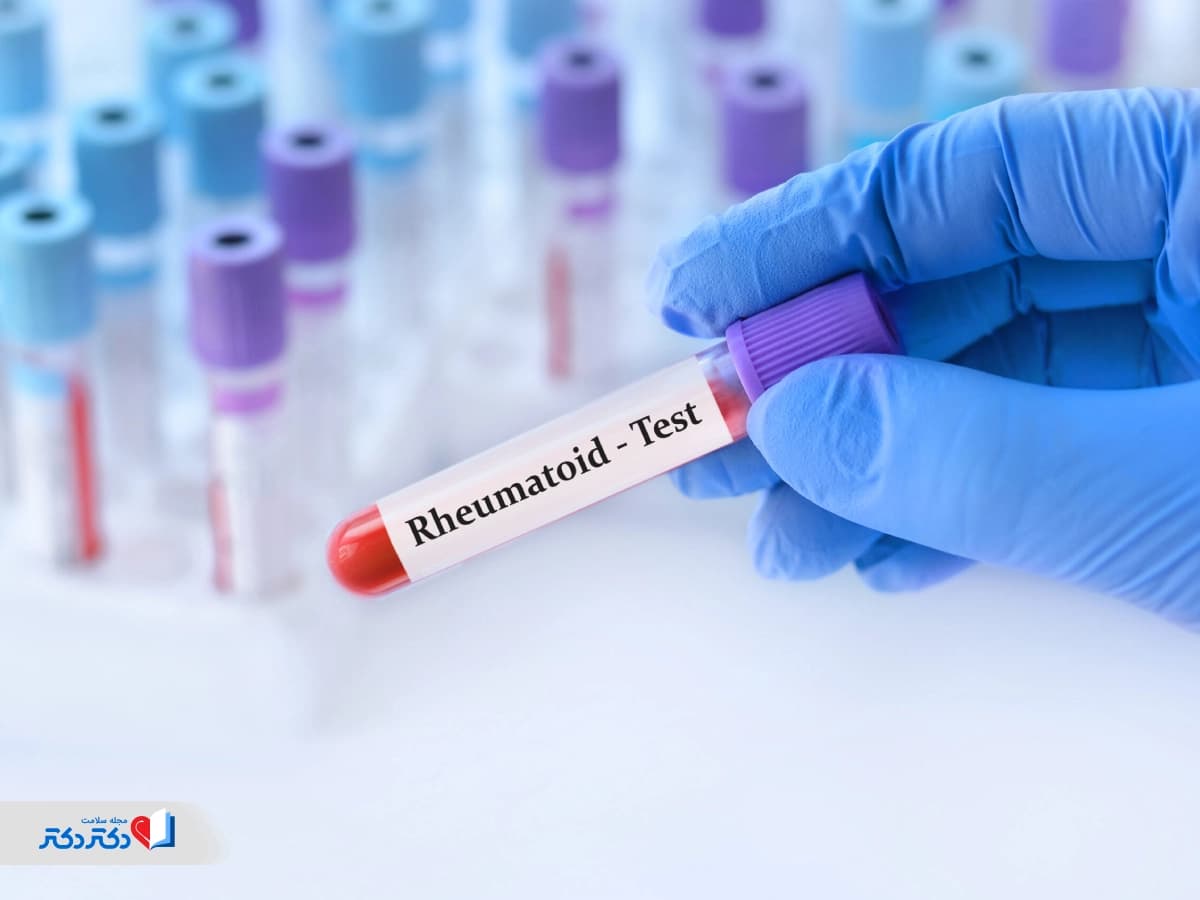 آزمایش روماتیسم چیست و چگونه به تشخیص بیماریهای مفصلی کمک میکند؟
